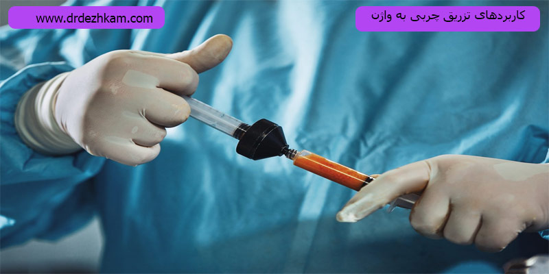 کاربرد-تزریق-چربی-به-وازن