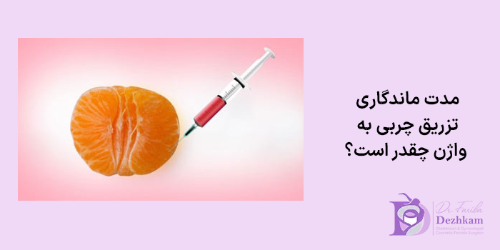مدت ماندگاری تزریق چربی به واژن