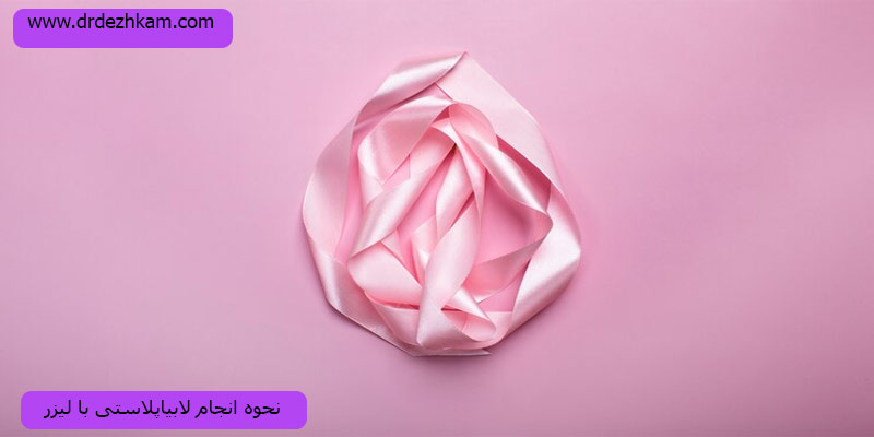 نحوه-انجام-لابیاپلاستی-با-لیزر