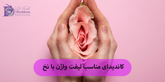 کاندیدای مناسب لیفت واژن با نخ