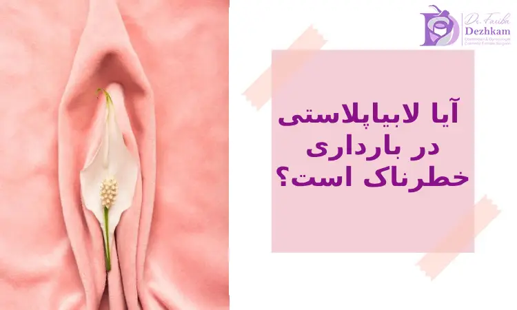آیا بعد از زایمان به لابیاپلاستی ترمیمی نیاز است؟