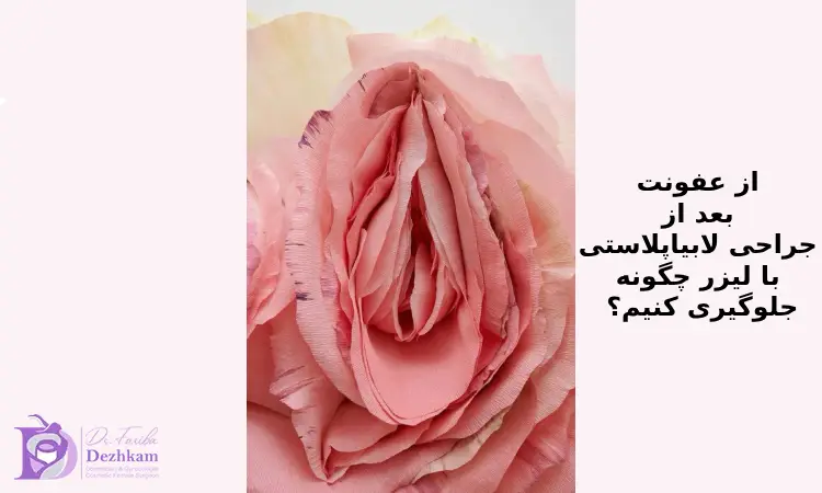 از عفونت بعد از جراحی لابیاپلاستی با لیزر چگونه جلوگیری کنیم؟