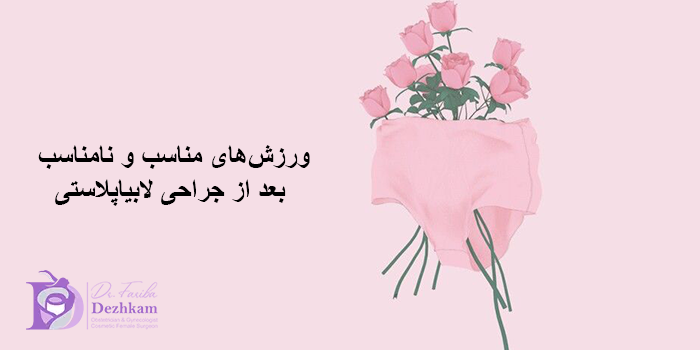 بهترین زمان برای شروع ورزشهای سنگین بعد از عمل لابیاپلاستی