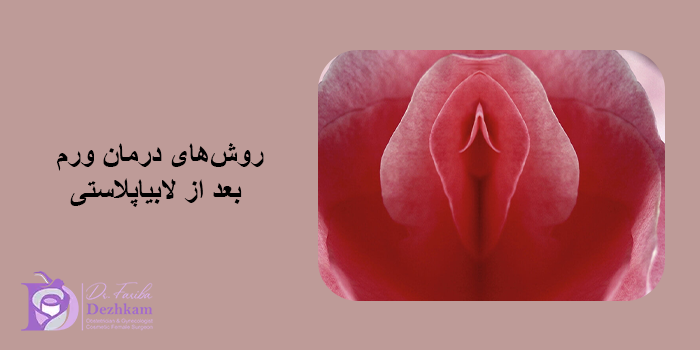 روشهای درمان ورم بعد از لابیاپلاستی