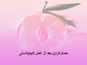 حمام کردن بعد از عمل لابیاپلاستی