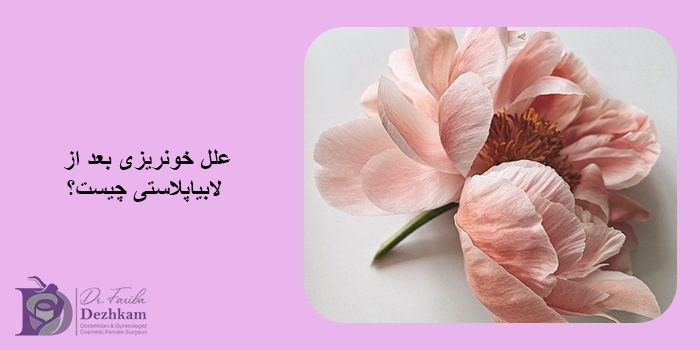 خونریزی بعد از لابیاپلاستی