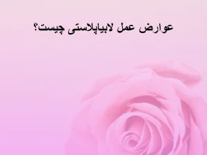 عوارض لابیاپلاستی