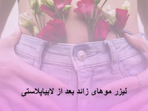 لیزر موهای زائد بعد از لابیاپلاستی