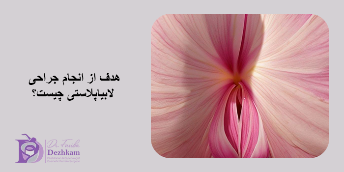 مزایای لابیاپلاستی