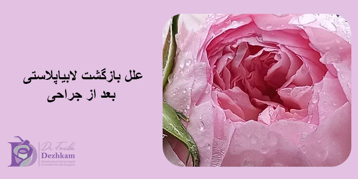 بازگشت لابیاپلاستی