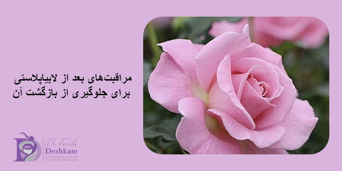 بازگشت لابیاپلاستی