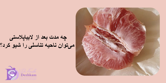 شیو کردن قبل از لابیاپلاستی