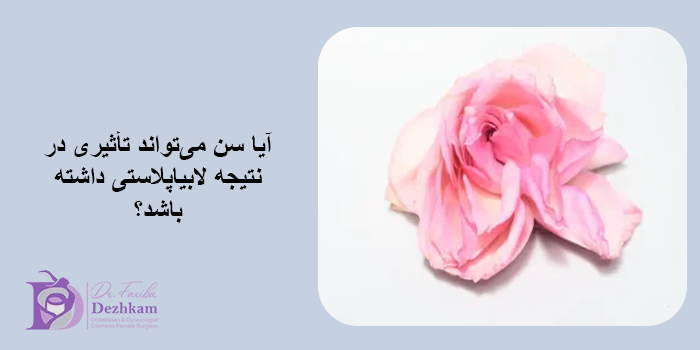 بهترین سن لابیاپلاستی