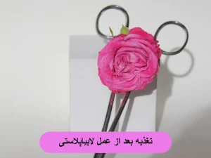 تغذیه بعد از لابیاپلاستی