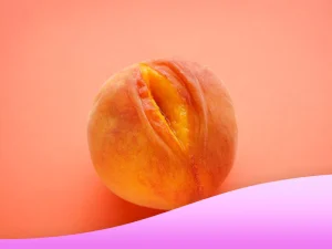 جراحی همزمان لابیاپلاستی و تزریق چربی