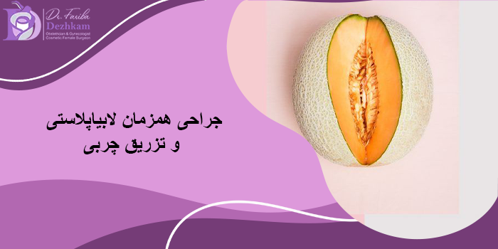جراحی همزمان لابیاپلاستی و تزریق چربی