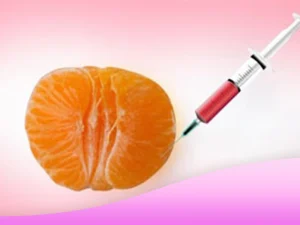 ماندگاری تزریق چربی به واژن