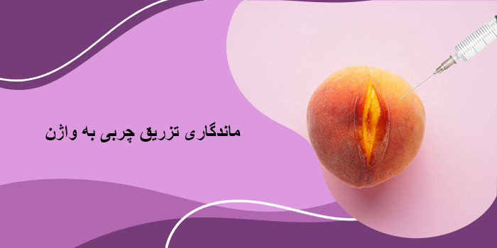 ماندگاری تزریق چربی