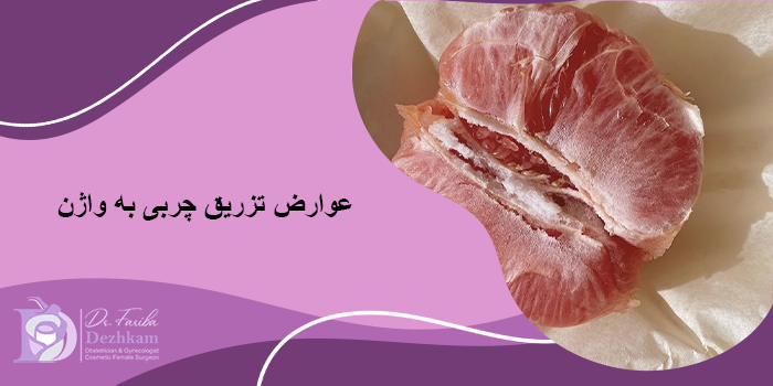 عوارض تزریق چربی به واژن