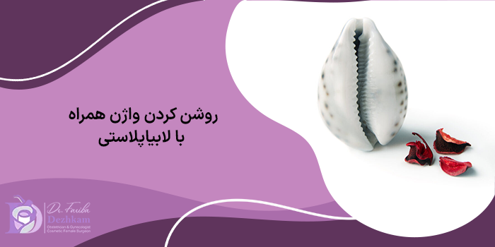 روشن کردن واژن همراه با لابیاپلاستی