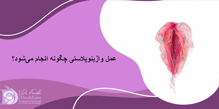 واژینوپلاستی چیست؟