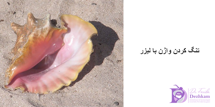 تنگ کردن واژن با لیزر برای چه افرادی مناسب است؟