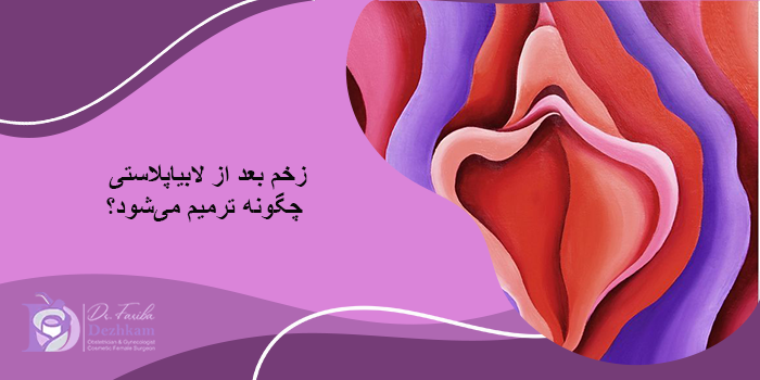 درمان زخم لابیاپلاستی