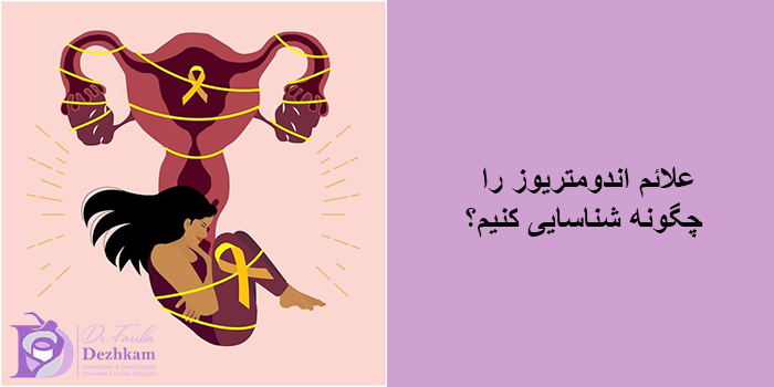 اندومتریوز
