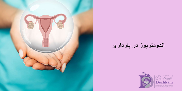 اندومتریوز در بارداری