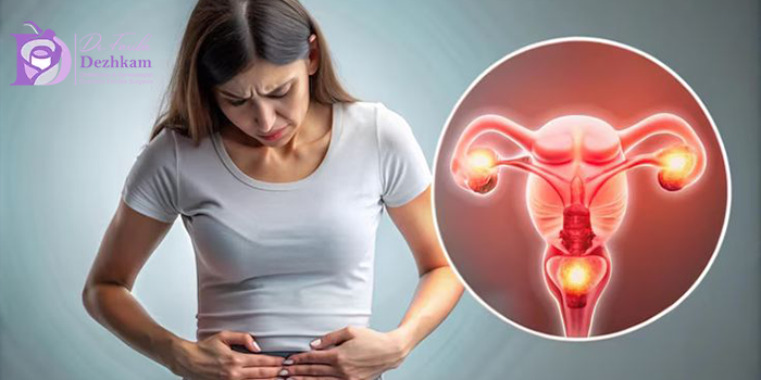 تفاوت آندومتریوز و آدنومیوز