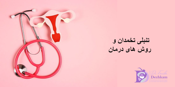 تنبلی تخمدان و روش های درمان