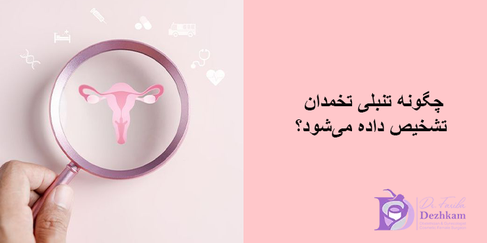 چگونه تنبلی تخمدان تشخیص داده میشود؟