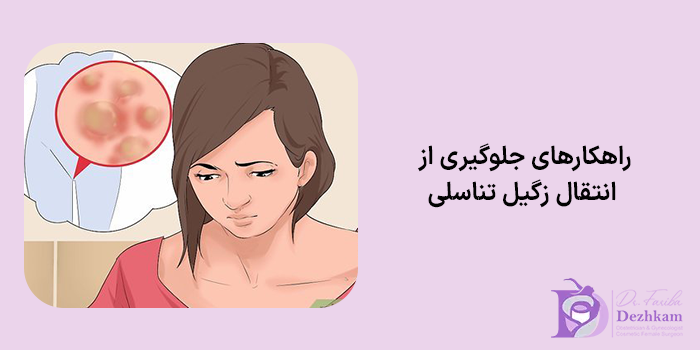 راهکارهای جلوگیری از انتقال زگیل تناسلی