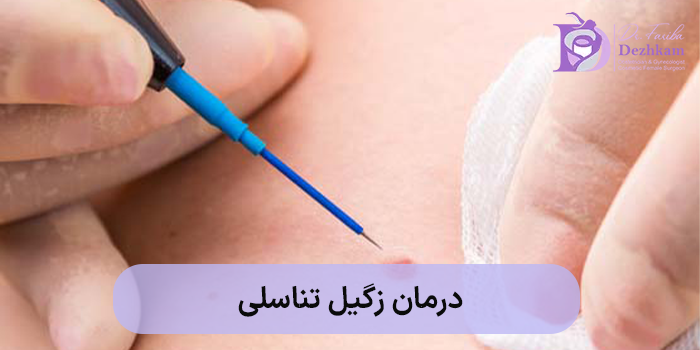 درمان زگیل تناسلی