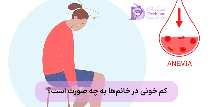 کم خونی در خانمها