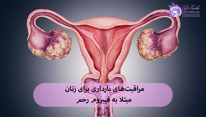 مراقبتهای بارداری برای زنان مبتلا به فیبروم رحم