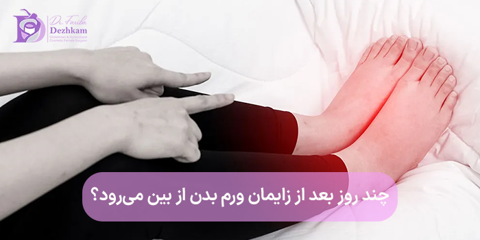 چند روز بعد از زایمان ورم بدن از بین میرود؟