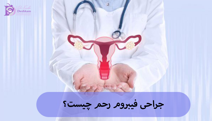 جراحی فیبروم رحم