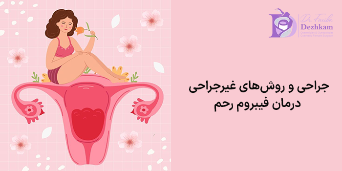 جراحی و روشهای غیرجراحی درمان فیبروم رحم