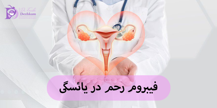 فیبروم رحم در یائسگی