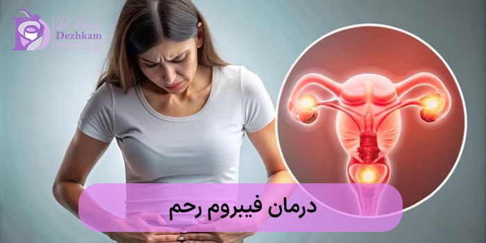 درمان فیبروم رحم