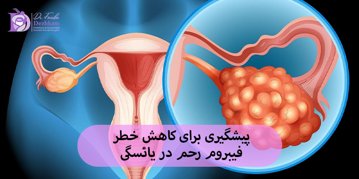 پیشگیری برای کاهش خطر فیبروم رحم در یائسگی