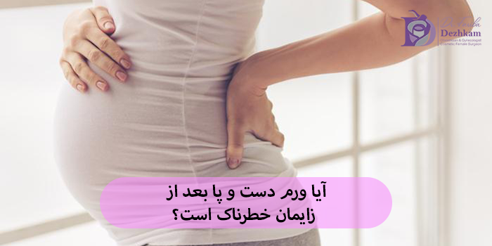 آیا ورم دست و پا بعد از زایمان خطرناک است؟