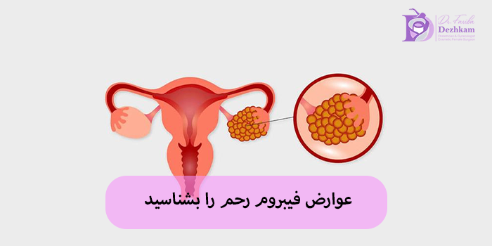 عوارض فیبروم رحم