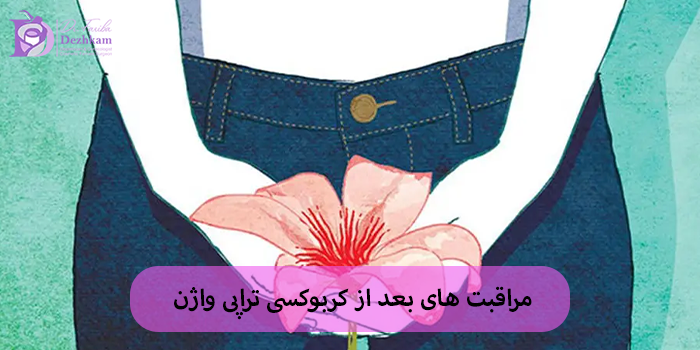 مراقبت های بعد از کربوکسی تراپی واژن و رعایت نکات ضروری